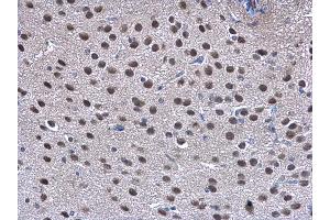 IHC-P Image TRIP15 antibody detects TRIP15 protein at cytoplasm and nucleus on mouse fore brain by immunohistochemical analysis.