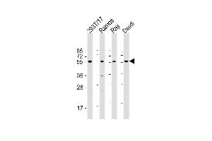 All lanes : Anti-FCRL4 Antibody (C-term) at 1:2000 dilution Lane 1: 293T/17 whole cell lysate Lane 2: Ramos whole cell lysate Lane 3: Raji whole cell lysate Lane 4: Daudi whole cell lysate Lysates/proteins at 20 μg per lane.