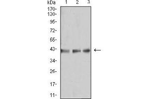 Western Blotting (WB) image for anti-beta-1,3-Glucuronyltransferase 1 (Glucuronosyltransferase P) (B3GAT1) (AA 193-334) antibody (ABIN5917282) (CD57 anticorps  (AA 193-334))