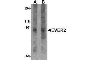 Image no. 1 for anti-Transmembrane Channel-Like 8 (TMC8) (N-Term) antibody (ABIN1494395) (TMC8 anticorps  (N-Term))