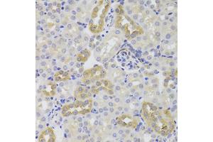 Immunohistochemistry of paraffin-embedded mouse kidney using TSC22D3 Antibody (ABIN5974107) at dilution of 1/100 (40x lens). (TSC22D3 anticorps)