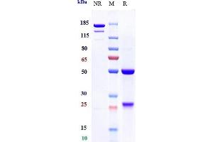 Anti-IL-7Ra / CD127 Reference Antibody (PF-06342674) on SDS-PAGE under reducing (R) condition.