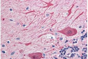 anti-Syntaxin 2 (STX2) (AA 1-19) antibody