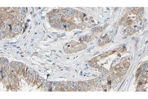 ABIN6278588 at 1/100 staining Human prostate tissue by IHC-P. (GAL4 anticorps  (N-Term))