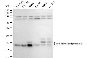 Western blotting analysis using TNF alpha induced protein 8 antibody (ABIN7800679). (Recombinant TNFAIP8 anticorps)