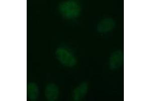 Image no. 2 for anti-Tubulin, beta 2B (TUBB2B) antibody (ABIN1501571)