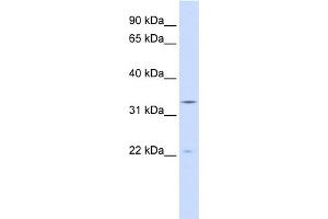 WB Suggested Anti-INMT Antibody Titration:  0. (INMT anticorps  (N-Term))