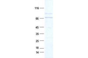 Validation with Western Blot