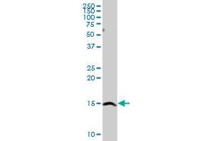 SH2D1A MaxPab rabbit polyclonal antibody. (SH2D1A anticorps  (AA 1-128))