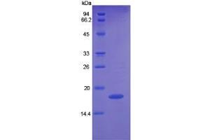 Rabbit Detection antibody from the kit in WB with Positive Control: Sample Human K562 cell lysate. (Angiopoietin 2 Kit CLIA)