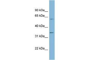 WB Suggested Anti-OSGEP Antibody Titration: 0. (OSGEP anticorps  (Middle Region))