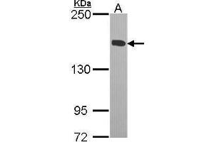 WB Image Sample (30 ug of whole cell lysate) A: H1299 5% SDS PAGE antibody diluted at 1:1000