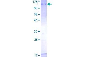 Image no. 1 for Topoisomerase (DNA) III beta (TOP3B) (AA 1-862) protein (GST tag) (ABIN1323351)