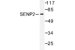 Image no. 1 for anti-SUMO1/sentrin/SMT3 Specific Peptidase 2 (SENP2) antibody (ABIN271956) (SENP2 anticorps)