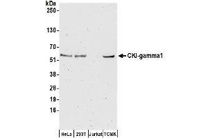 Western Blotting (WB) image for anti-Casein Kinase 1, gamma 1 (CSNK1G1) (AA 1-50) antibody (ABIN7453063)