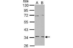 WB Image Sample (30 ug of whole cell lysate) A: PC-3 B: SK-N-SH 10% SDS PAGE antibody diluted at 1:10000 (GGPS1 anticorps)