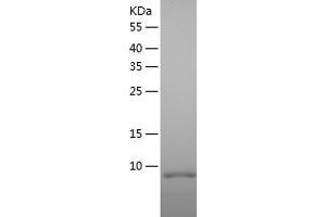 Western Blotting (WB) image for Tumor Necrosis Factor Receptor Superfamily, Member 17 (TNFRSF17) (AA 5-54) protein (His-IF2DI Tag) (ABIN7125551)