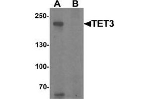Western blot analysis of TET3 in SK-N-SH cell lysate with TET3 Antibody  at 1 μg/ml in (A) the absence and (B) the presence of blocking peptide (TET3 anticorps  (C-Term))