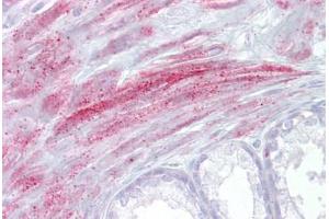 Anti-TRPM8 antibody IHC staining of human prostate.