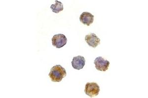 Immunohistochemistry (IHC) image for anti-RAR-Related Orphan Receptor C (RORC) (N-Term) antibody (ABIN1031636)