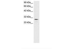 Image no. 3 for anti-Orthodenticle Homeobox 2 (OTX2) (AA 86-135) antibody (ABIN6735803) (OTX2 anticorps  (AA 86-135))