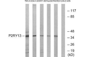 Western Blotting (WB) image for anti-Purinergic Receptor P2Y, G-Protein Coupled, 13 (P2RY13) (Internal Region) antibody (ABIN1853312) (Purinergic Receptor P2Y, G-Protein Coupled, 13 (P2RY13) (Internal Region) anticorps)