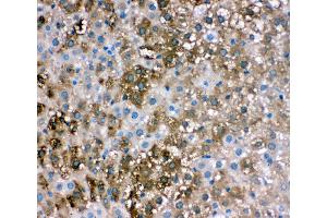 Anti-liver FABP antibody,  IHC(P) IHC(P): Rat Liver Tissue