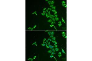 anti-Inositol Polyphosphate-5-Phosphatase J (INPP5J) (AA 60-360) antibody