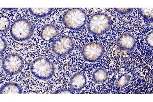 Detection of GCSFR in Human Appendix Tissue using Polyclonal Antibody to Colony Stimulating Factor Receptor, Granulocyte (GCSFR)