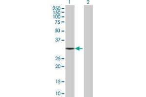 Western Blot analysis of TBCB expression in transfected 293T cell line by TBCB MaxPab polyclonal antibody. (TBCB anticorps  (AA 1-244))