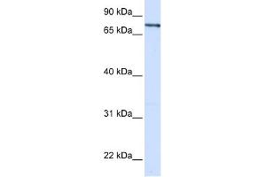 WB Suggested Anti-ZNF180 Antibody Titration:  0. (ZNF180 anticorps  (Middle Region))