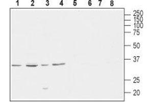 Western blot analysis of rat brain (lanes 1 and 5), mouse brain (lanes 2 and 6), human SH-SY5Y brain neuroblastoma (lanes 3 and 7) and  rat PC12 pheochromocytoma adrenal gland (lanes 4 and 8) lysates: - 1-4.
