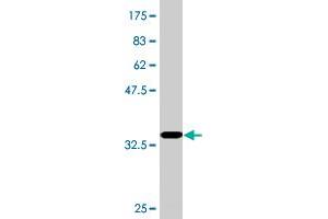 Western Blot detection against Immunogen (36. (RPRD1A anticorps  (AA 76-170))