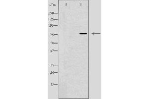 Western blot analysis of extracts from NIH-3T3 cells treated with H2O2 using DBF4 antibody.