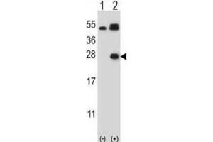 Western Blotting (WB) image for anti-Kallikrein 6 (KLK6) antibody (ABIN5022442) (Kallikrein 6 anticorps)