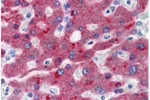 Human Liver (formalin-fixed, paraffin-embedded) stained with CFH antibody ABIN364283 at 20 ug/ml followed by biotinylated anti-mouse IgG secondary antibody ABIN481714, alkaline phosphatase-streptavidin and chromogen. (Complement Factor H anticorps)