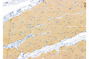 ABIN6265412 and ABIN6279864 at 1/100 staining Rat skin tissue by IHC-P.