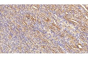 Detection of HSP90aA1 in Rat Kidney Tissue using Polyclonal Antibody to Heat Shock Protein 90 kDa Alpha A1 (HSP90aA1)
