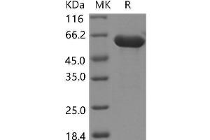 Western Blotting (WB) image for Hexosaminidase B (Beta Polypeptide) (HEXB) protein (His tag) (ABIN7320023)