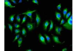 anti-KIAA0319 (KIAA0319) (AA 153-268) antibody