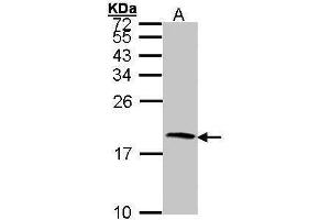 WB Image Sample (30 ug of whole cell lysate) A: Hep G2 , 15% SDS PAGE antibody diluted at 1:1000 (CST4 anticorps  (N-Term))
