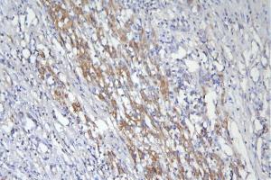 IHC analysis of CD46 using anti-CD46 antibody (ABIN7602758).