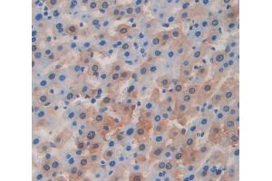 Used in DAB staining on fromalin fixed paraffin- embedded Kidney tissue (ITIH1 anticorps  (AA 412-664))