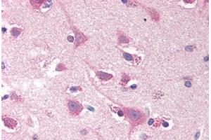Human Brain, Cortex (formalin-fixed, paraffin-embedded) stained with SMOC2 antibody ABIN290277 at 20 ug/ml followed by biotinylated goat anti-rabbit IgG secondary antibody ABIN481713, alkaline phosphatase-streptavidin and chromogen. (SMOC2 anticorps  (N-Term))