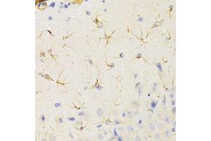 Immunohistochemistry of paraffin-embedded rat brain using KIF1B Antibody. (KIF1B anticorps  (AA 1501-1770))