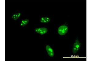 Immunofluorescence of monoclonal antibody to HIST1H4H on HeLa cell. (HIST1H4H anticorps  (AA 31-103))
