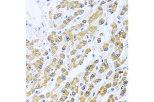 Immunohistochemistry of paraffin-embedded human liver using MANF antibody (ABIN6291535) at dilution of 1:100 (40x lens). (MANF anticorps)
