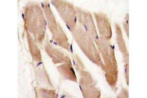 IHC analysis of FFPE human skeletal muscle stained with AMPK alpha 2 antibody