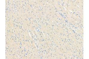 ABIN7094526 and ABIN7098575 at 1/100 staining Rat heart tissue by IHC-P. (GFRA3 anticorps  (Internal Region))