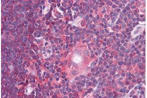 Human Thymus: Formalin-Fixed, Paraffin-Embedded (FFPE)